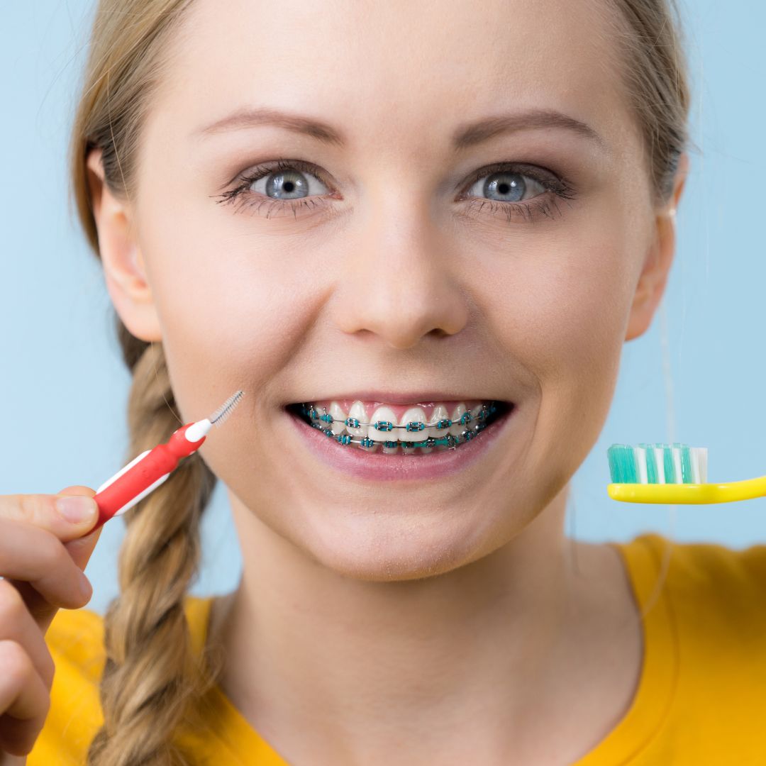 pulizia dei denti con apparecchio