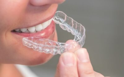 Ortodonzia Invisibile: innovazione e comfort nel correggere il sorriso