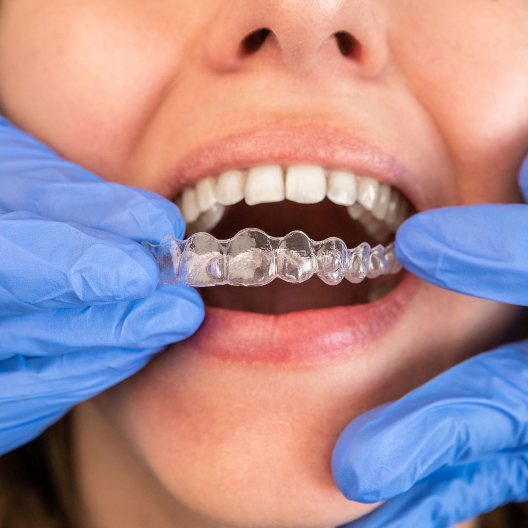 pulizia dei denti